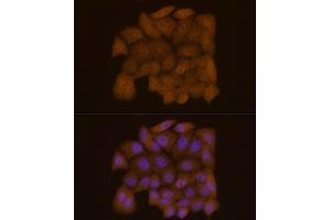 Immunofluorescence analysis of HeLa cells using Galectin 3/LG Rabbit mAb (ABIN7267337) at dilution of 1:50 (40x lens). (Galectin 3 抗体)