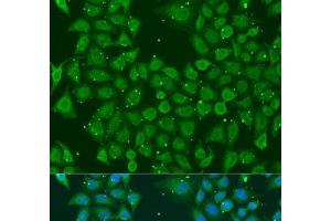 Immunofluorescence analysis of U2OS cells using AKR7A3 Polyclonal Antibody at dilution of 1:100. (AKR7A3 抗体)