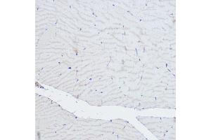 Immunohistochemistry of paraffin-embedded rat skeletal muscle using  Rabbit pAb (ABIN6127422, ABIN6136487, ABIN6136489 and ABIN6216551) at dilution of 1:500 (40x lens). (ACTN3 抗体  (AA 580-630))