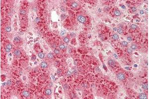 ABIN1590086 (5µg/ml) staining of paraffin embedded Human Liver. (CROT 抗体  (AA 178-199))