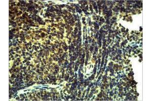 Immunohistochemistry (IHC) image for anti-Toll-Like Receptor 8 (TLR8) antibody (ABIN3179059) (TLR8 抗体)