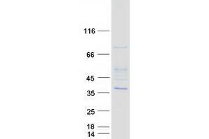 Western Blotting (WB) image for HUS1 Checkpoint Homolog (S. Pombe) (HUS1) protein (Myc-DYKDDDDK Tag) (ABIN2723131)