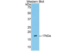 Western Blotting (WB) image for anti-Serpin Peptidase Inhibitor, Clade G (C1 Inhibitor), Member 1 (SERPING1) (AA 397-495) antibody (ABIN3208985) (SERPING1 抗体  (AA 397-495))