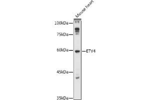 Western blot analysis of extracts of Mouse heart, using ETV4 antibody (ABIN6131216, ABIN6140331, ABIN6140333 and ABIN6218006) at 1:1000 dilution. (ETV4 抗体  (AA 79-178))
