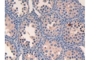 Immunohistochemistry (IHC) image for anti-Slit Homolog 3 (SLIT3) (AA 1348-1517) antibody (ABIN7438367)