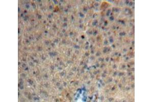Used in DAB staining on fromalin fixed paraffin-embedded Liver tissue (HRG 抗体  (AA 106-302))