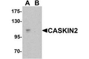 Western blot analysis of CASKIN2 in Hela cell lysate with CASKIN2 Antibody  at 1 ug/mL in (A) the absence and (B) the presence of blocking peptide. (CASKIN2 抗体  (N-Term))