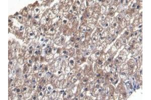 Detection of LEP in Human Liver Tissue using Monoclonal Antibody to Leptin (LEP) (Leptin 抗体  (AA 22-167))