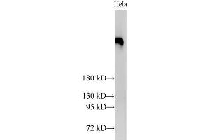 Western Blot analysis of Hela cells using BRCA2 Polyclonal Antibody at dilution of 1:2000 (BRCA2 抗体)