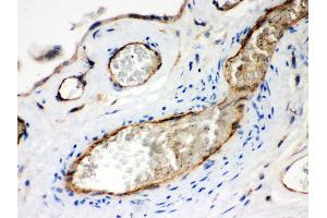 IHC(P): Human Placenta Tissue (Neuropilin 1 抗体  (AA 504-827))