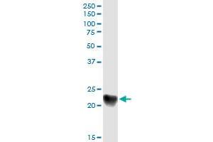 Immunoprecipitation (IP) image for anti-Complement Component 1, Q Subcomponent, C Chain (C1QC) (AA 1-245) antibody (ABIN513856)