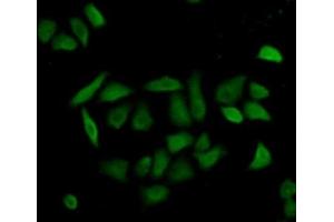 Detection of CASP8 in Hela cells using Polyclonal Antibody to Caspase 8 (CASP8) (Caspase 8 抗体  (AA 217-384))