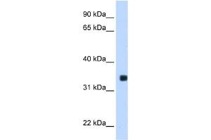 WB Suggested Anti-MLX Antibody Titration:  0. (MLX 抗体  (C-Term))