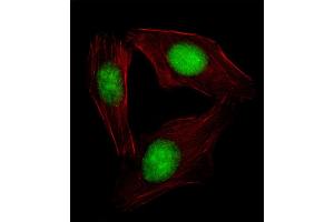 Immunofluorescence (IF) image for anti-Sterol Regulatory Element Binding Transcription Factor 2 (SREBF2) (AA 399-427) antibody (ABIN654630)