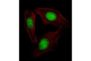 Fluorescent image of  cell stained with SREBF2 Antibody (Center) (ABIN654630 and ABIN2844326). (SREBF2 抗体  (AA 399-427))