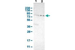 Western Blot analysis with PKP2 polyclonal antibody . (Plakophilin 2 抗体  (AA 72-194))