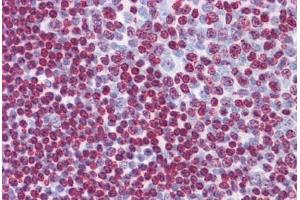 Human Tonsil: Formalin-Fixed, Paraffin-Embedded (FFPE) (ATR 抗体  (AA 2545-2645))