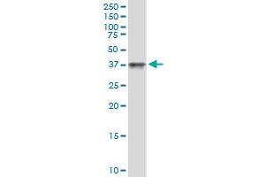 Immunoprecipitation of MAGEA11 transfected lysate using anti-MAGEA11 MaxPab rabbit polyclonal antibody and Protein A Magnetic Bead , and immunoblotted with MAGEA11 MaxPab mouse polyclonal antibody (B01) . (MAGEA11 抗体  (AA 1-319))