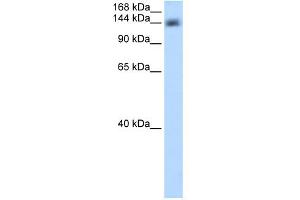 WB Suggested Anti-CPSF1 Antibody Titration:  0.