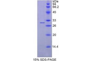 SDS-PAGE analysis of Human Azurocidin 1 Protein. (Azurocidin 蛋白)