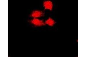 Immunofluorescent analysis of PHF17 staining in U2OS cells. (PHF17 抗体)