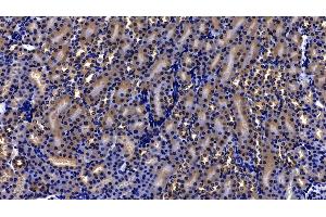 Immunohistochemistry (IHC) image for anti-Peroxiredoxin 2 (PRDX2) (AA 6-164) antibody (ABIN7437812)