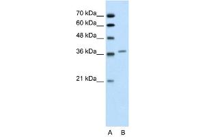 WB Suggested Anti-ALAD  Antibody Titration: 0. (ALAD 抗体  (Middle Region))