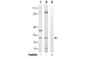 Western blot analysis of extracts from NIH/3T3 cells (Lane 1) and COLO 205 cells (Lane 2 and lane 3), using APOOL polyclonal antibody . (APOOL 抗体)