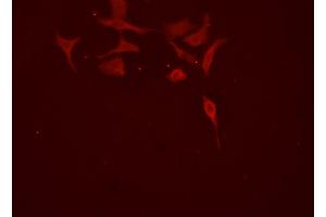ABIN6277869 staining HEPG2 cells by ICC/IF. (SMURF2 抗体  (Internal Region))