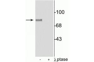 Western blot of rat brain lysate showing specific immunolabeling of the ~87 kDa MARCKS protein phosphorylated at Ser152,156, in the first lane (-). (MARCKS 抗体  (pSer152, pSer156))