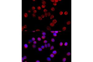 Immunofluorescence (IF) image for anti-Cytochrome P450, Family 11, Subfamily B, Polypeptide 2 (CYP11B2) (AA 234-503) antibody (ABIN1679468)