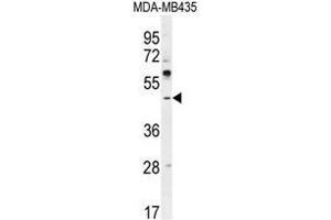 ATF4 Antibody (Center) western blot analysis in MDA-MB435 cell line lysates (35µg/lane). (ATF4 抗体  (Middle Region))