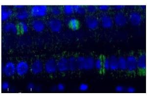 Immunofluorescence (IF) image for anti-Tubulin, beta (TUBB) antibody (ABIN619536) (TUBB 抗体)