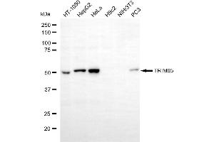 Western blotting analysis using TRIM65 antibody (ABIN7800641). (TRIM65 抗体)