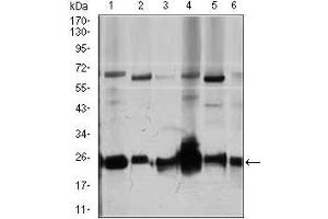 Western blot analysis using ARHGDIA mouse mAb against Jurkat (1), HeLa (2), NIH3T3 (3), C6 (4), K562 (5), and COS7 (6) cell lysate. (ARHGDIA 抗体  (AA 1-204))