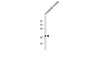 Anti-TRIB1 Antibody C-term at 1:2000 dilution + human skeletal muscle lysate Lysates/proteins at 20 μg per lane.