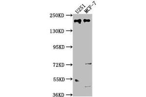 Western Blot Positive WB detected in: U251 whole cell lysate, MCF-7 whole cell lysate All lanes: UNC13B antibody at 1:2000 Secondary Goat polyclonal to rabbit IgG at 1/50000 dilution Predicted band size: 181, 183 kDa Observed band size: 181 kDa (UNC13B 抗体  (AA 12-215))