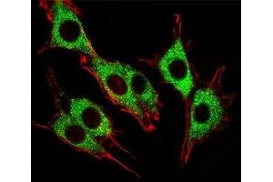Fluorescent image of PC12 cells stained with Pink1 antibody. (PINK1 抗体)