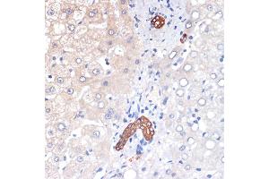 Immunohistochemistry of paraffin-embedded human liver using p53 DINP1 Rabbit mAb (ABIN7271097) at dilution of 1:100 (40x lens). (TP53INP1 抗体)