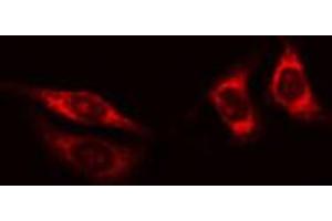 ABIN6268946 staining HT29 cells by IF/ICC. (TXNRD2 抗体  (C-Term))