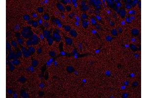 Immunohistochemistry (Paraffin-embedded Sections) (IHC (p)) image for anti-Solute Carrier Family 1 (Glial High Affinity Glutamate Transporter), Member 2 (SLC1A2) (AA 146-161), (Extracellular Domain) antibody (ABIN1742506)