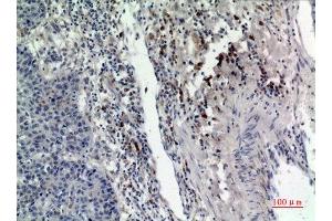 Immunohistochemistry (IHC) image for anti-RAB5A, Member RAS Oncogene Family (RAB5A) (Internal Region) antibody (ABIN3187950)