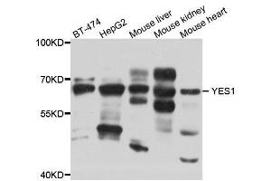 Western blot analysis of extracts of 293 cell line, using YES1 antibody. (YES1 抗体  (AA 1-250))