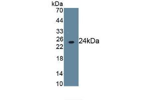 Detection of Recombinant FcgR3B, Human using Monoclonal Antibody to Fc Fragment Of IgG Low Affinity IIIb Receptor (FcgR3B) (FCGR3B 抗体  (AA 24-203))