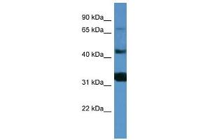 Western Blot showing MFI2 antibody used at a concentration of 1-2 ug/ml to detect its target protein. (MFI2 抗体  (C-Term))