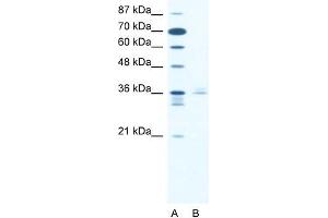 Human Jurkat; WB Suggested Anti-LHX3 Antibody. (LHX3 抗体  (Middle Region))