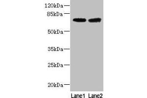 Western blot All lanes: GALNT15 antibody at 5 μg/mL Lane 1: Mouse liver tissue Lane 2: Mouse kidney tissue Secondary Goat polyclonal to rabbit IgG at 1/10000 dilution Predicted band size: 74 kDa Observed band size: 74 kDa (GALNT14 抗体  (AA 35-335))