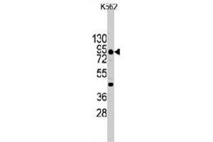 Western blot analysis of CDH3 (arrow) using rabbit CDH3 polyclonal antibody  in K-562 cell line lysates (35 ug/lane). (P-Cadherin 抗体  (C-Term))