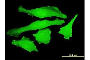 Immunofluorescence of monoclonal antibody to USP10 on HeLa cell. (USP10 抗体  (AA 699-797))
