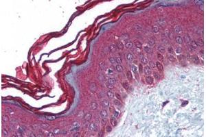 Human Skin (formalin-fixed, paraffin-embedded) stained with PERP antibody ABIN213966 at 5 ug/ml followed by biotinylated goat anti-rabbit IgG secondary antibody ABIN481713, alkaline phosphatase-streptavidin and chromogen. (PERP 抗体  (C-Term))